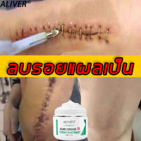 【ลดราคาครั้งใหญ่】ALIVER ครีมลดรอยแผลเป็น ครีมกำจัดรอยแผลเป็น50ml ลบรอยแผลเป็นใหม่และรอยแผลเป็นเก่าได้อย่างมีประสิทธิภาพ (ครีมลบแผลเป็น ครีมรักษาแผลเป็น ครีมลบรอยแผลเป็น แผลไฟไหม้  ครีมลดรอยแผลไฟไหม้ น้ำร้อนลวก รอยแตกลายหลังคลอด ครีมลดรอยสิว ครีมทาแผลเป็น)