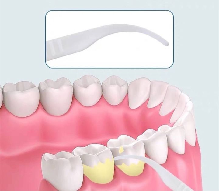 dental-flossier-ไหม้ขัดฟัน-50ชิ้น-ไหมขัดซอกฟัน-ไหม้ขัดฟันหัวปลายแหลมแคะเศษอาหาร-ที่ขัดฟัน-ที่ขัดฟันขาว-ที่ขูดฟัน-ที่ขัดซอกฟัน