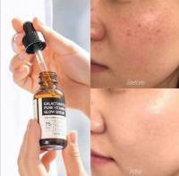 exp. 2024 ผิวขาวสว่างเนียนใส ลดแผลเป็น ฝ้ากระ ใน 7 วัน SOME BY MI GALACTOMYCES PURE VITAMIN C GLOW SERUM 30ml. เซรั่มวิตามินซีซัมบายมี เซรั่มผิวขาว