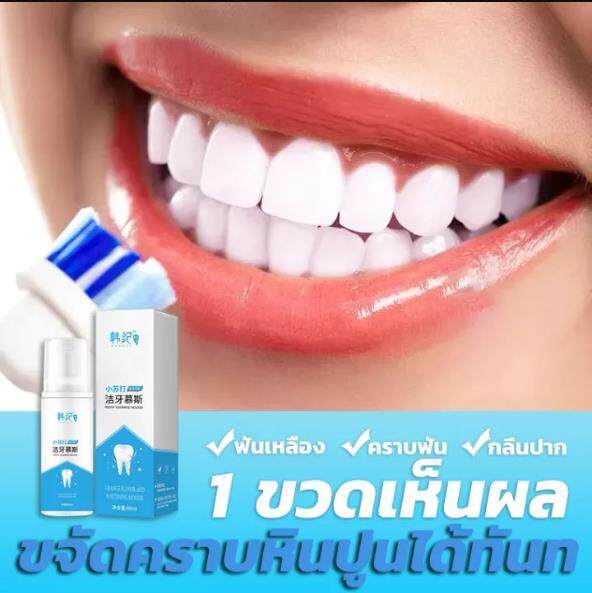 ฟทําให้คุณยิ้มได้อย่างมั่นใจ-กําจัดนิ่วในฟัน-ฟันขาวขึ้น-hangji-มูสแปรงฟัน-ฟอกฟันขาว-หินปูน-น้ำยากำจัดหินปูน-ยาสีฟันฟอกฟันขาว-ขจัดคราบหินปูน-ยาสีฟันฟันขาว-น้ำยากัดหินปูน-ดับกลิ่นปาก-มูส์แปรงขาวใส-ซ่อมฟ