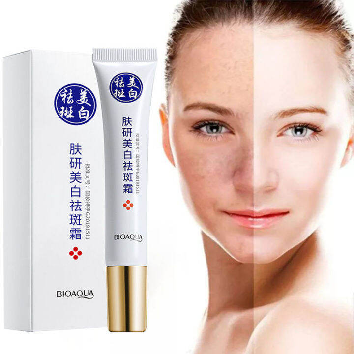 Whitening freckle removal cream original dark spot remover Dark Spot ...