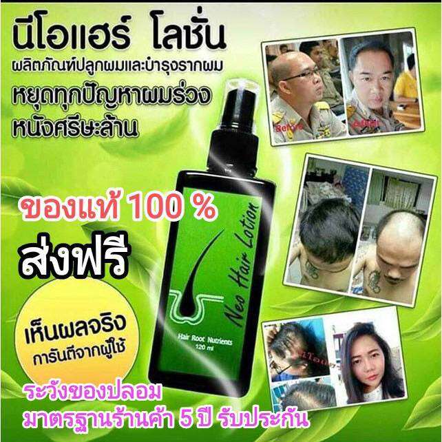 neo-hair-lotion-ของแท้-4-ขวด-เซรั่มปลูกผม-นีโอแฮร์โลชั่น-neohair-นีโอแฮร์-ของแท้-4-ขวด