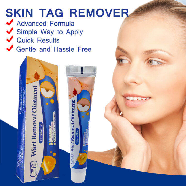 ZB Warts Removal Cream Skin Growth Warts Mole And Warts Remover Quick ...