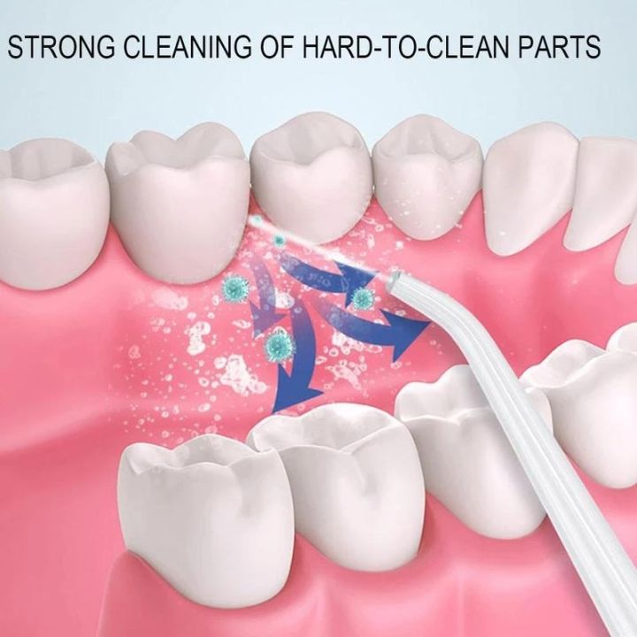 ชลประทานช่องปาก-ทันตกรรมชลประทาน-น้ำยาทำความสะอาดฟัน-แปรงสีฟันไฟฟ้า-ถังเก็บน้ำใหญ่-300-มล-ไหมขัดฟัน-เครื่องทำความสะอาดฟัน-ฟอกฟันขาว-ทำความสะอาดฟัน-ไหมขัดฟันพลังน้ำ-ฉีดล้างฟัน-แปลงสีฟันน้ำ-oral-irrigat