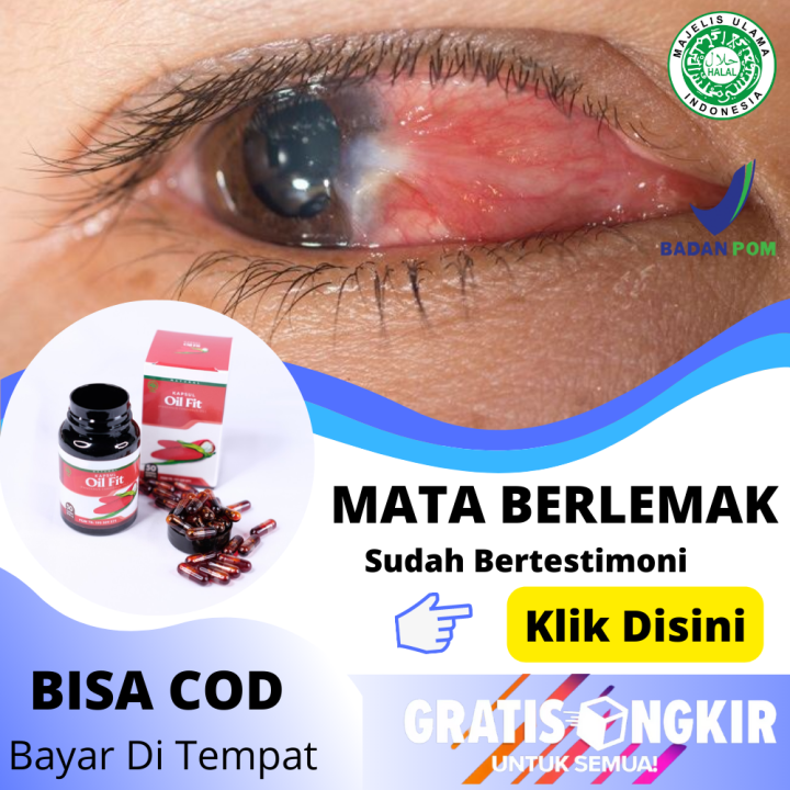 Obat Lemak Di Mata Menghilangkan Timbul Lemak Di Kornea Mata Herbal