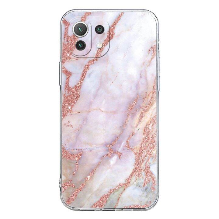 enjoy-electronic-phone-case-for-xiaomi-mi-11-lite-5g-soft-tpu-clear-back-cover-for-xiaomi-mi-11-lite-11lite-mi11-coqueluxury-marble-texture-capa