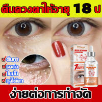 ?หนุ่มสาวและมีพลัง?ครีมทารอบดวงตา30ml ตีนกา รอยคล้ำใต้ตา ถุงใต้ตา ลดบวม ชะลอความแก่ของผิว ให้ความชุ่มชื่น ขอบตาดำ ถุงใต้ตา ริ้วรอย รอยตีนกา ริ้วรอยร่องแก้ม ตาบวม าลดริ้วรอย ขจัดอนุภาคไขมัน บำรุงผิวรอบดวงตา เซรั่มถุงใต้ตา ครีมทาตาเม็ดไขมัน ครีมทารอบดวงตา