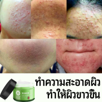 ซื้อ 1 แถม 1 กำจัดสิว 50g ลดสิวเสี้ยนครีมรักษาสิว สลายสิวอุดตันที่ต้นตอ อ่อนโยนและไม่ระคาย เจลแต้มสิว เจลละลายสิว ครีมลดสิว เจลรักษาสิว ครีมกำจัดสิว ครีมทาสิว ครีมแต้มสิว ครีมสลายสิว ครีมทารอยสิว