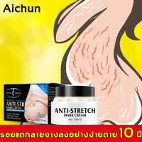 รอยแตกลายจางลงอย่างง่ายดาย 10 ปีครีมทาท้องลาย100gช่วยแม่หลังคลอด ท้องเรียบเนียนละเอียดอีกครั้ง（ครีมลดรอยแตกลาย ครีมลดรอยแตก ครีมท้องแตกลาย ครีมแก้ท้องลาย ลดผิวแตกลาย ครีมทาขาแตกลาย ครีมทาหน้าท้อง ครีมทารอยแตกลาย ครีมทาแตกลาย ครีมทาหลังคลอด ครีมทาลดรอยแตก）