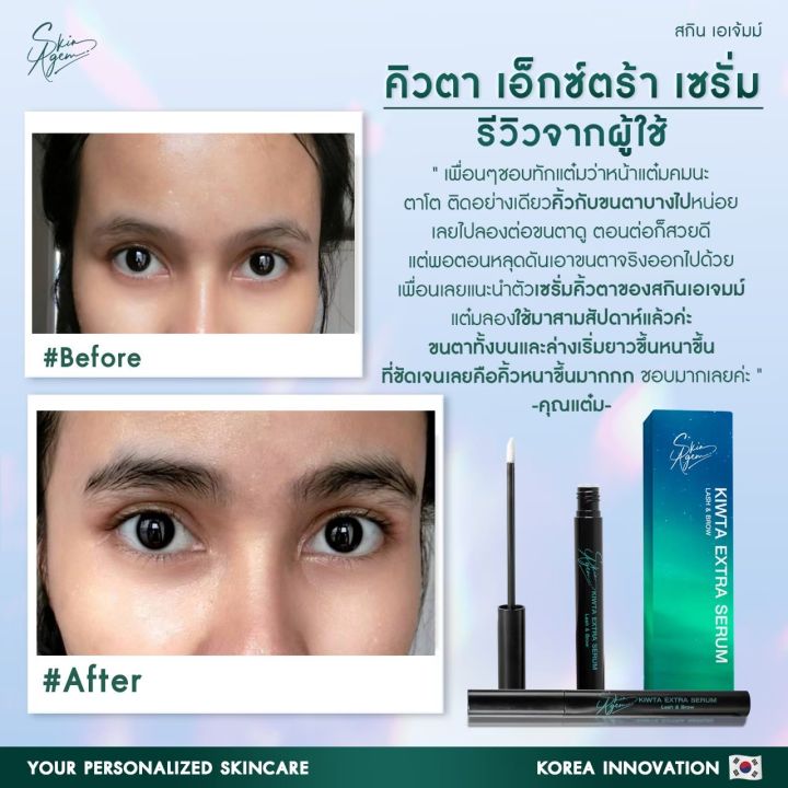 2-แถม-2-ล๊อตใหม่-ส่งไว-skin-agem-เซรั่มบำรุงคิ้วและตา-บำรุงขนตา-ยาวขึ้น-หนาขึ้น-kiwta-extra-serum