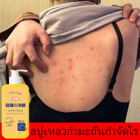 KABEINA สบู่เหลวกำมะถันกำจัดไร สบู่อาบน้ำขจัดไร 300ml ลบสิวควบคุมน้ำมัน ปรับสี ขจัดกลิ่นเหงื่อ ชะล้างรูขุมขน พร้อมฟื้นบำรุงผิว สบู่สมุนไพรธรรมชาติ ครีมอาบน้ำขาว เจลอาบน้ำกลิ่นหอม สบู่ สบู่เหลว ครีมอาบน้ำ ครีมอาบน้ำเด็กสบู่เหลว ครีมอาบน้ำหอม ครีมอาบน้ำหอมๆ