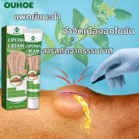 แท้OUHOE ออกแบบ36ชนิดของไขมันใต้ผิวหนังกำจัดมวลก้อนไปยังถุงน้ำ Lymph Care Ointment สมุนไพรกำจัด ก้อนเนื้อใต้ผิวหนัง ก้อนซีสต์ ก้อนไขมัน ครีมทาซีส ก้อนไขมัน ครีมระบายน้ำเหลือง ครีมน้ำเหลืองแบบอ่อนโยน ครีมบวมคอ ต่อมน้ำเหลืองบริเวณรักแร้ พร้อมส่งทั่ว