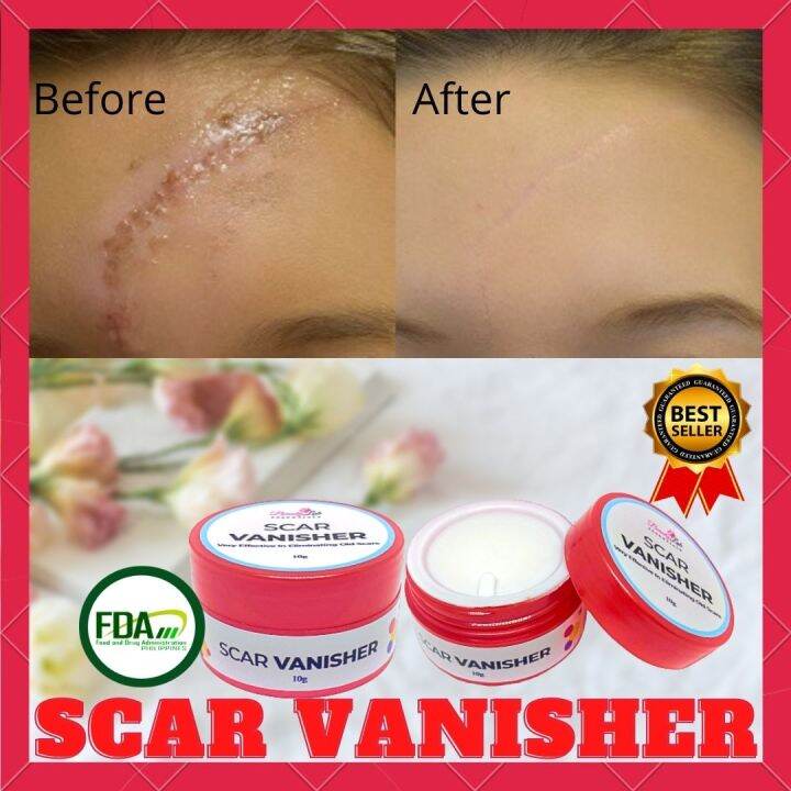 BEAUTY LAB ESSENTIALS SCAR VANISHER 10g Scar Removal Cream Repair burns