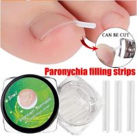 10pcs Ingrown Toenail Correction Tool Ingrown Toe Nail Treatment Elastic Patch Sticker Straightening Clip Brace Pedicure Tool Cleaning Tools