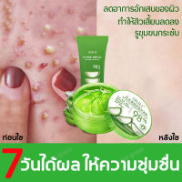 98% Aloe Vera Gel เจลว่านหางจระเข้ ว่านหางจระเข้ เจลว่านจระเข้ ว่านห่างจระเข้ เจลว่านหาง เจลว่านหางจรเข้ Moisture Face Cream Blackhead Acne Removal Gel Skincare Sleeping Mask