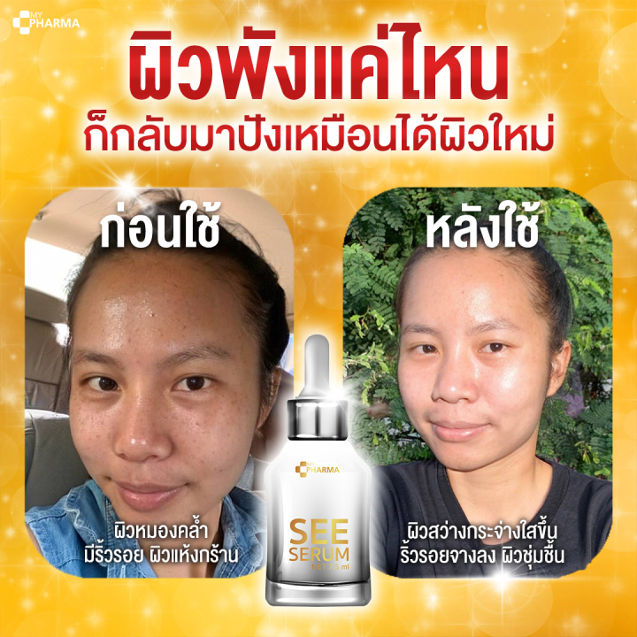 เซรั่มลดฝ้า-เซรั่มลดฝ้ากระ-เซรั่มลดฝ้ากระจุดด่างดำ-see-serum-แบรนด์-my-pharma-โปรสุดคุ้ม-ส่งฟรี