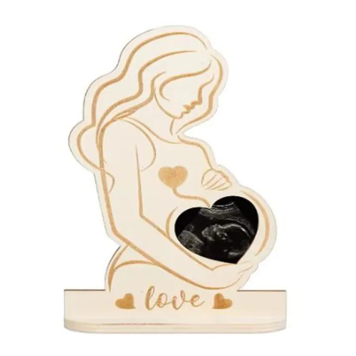  Ultrasound Picture Frame