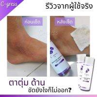 C-gress เช็ดคอดำ รักแร้ ตาตุ่ม หายถาวร 100 ml ของแท้