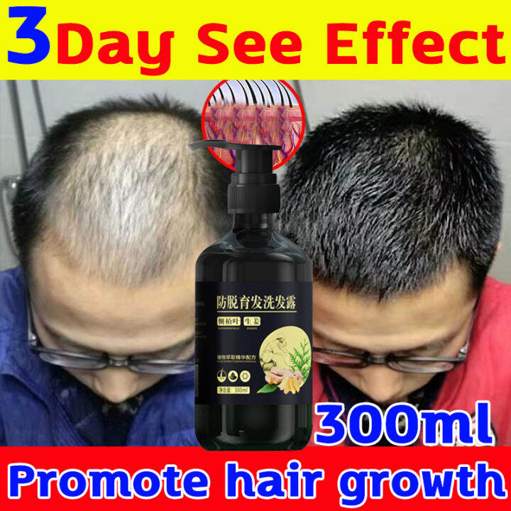 3Day See Effect zhenxiu ginger hair growth shampoo 100 Original