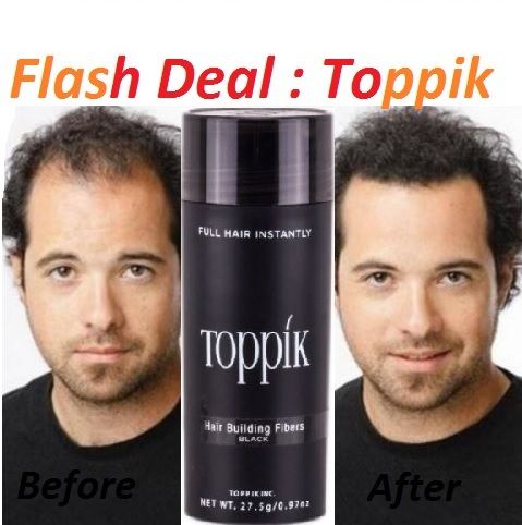 Toppik Hair Building Fibers Original Spray Applicator Kit Hair Loss  Solution Treatment Care Set | Lazada
