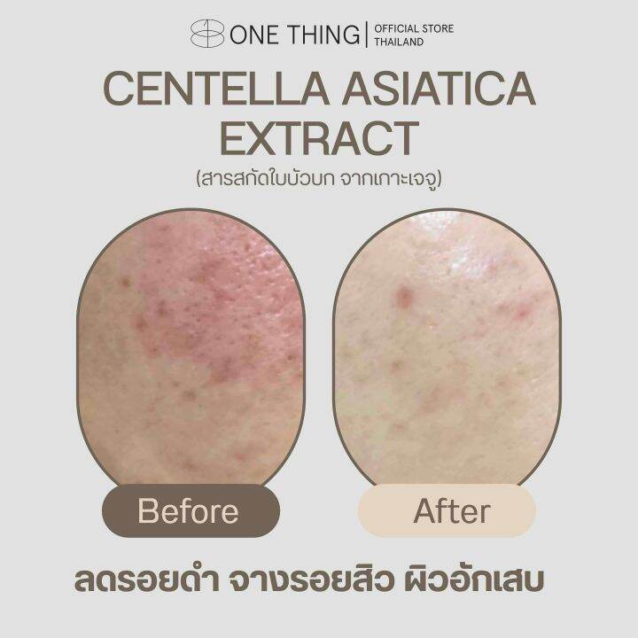 โทนเนอร์ลูกคุณตัวดัง-centella-asiatica-extract-จางรอยสิว-ลดผิวอักเสบ-exp-2026-สำหรับทุกสภาพผิว