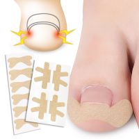 CW 12 4PCS Ingrown Toenail Corrector StickerStrip Anti rollGlue Toe InlayCorrectorIngrown Toenail Stickers