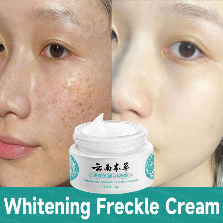 Effective Japanese Melasma Cream Yunnan Herbal Whitening Freckle Cream ...