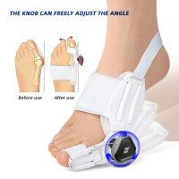 ✻▼☃ 1Piece Big Toe Straightener Foot Care Tool Supplies Corrector Adjustable Knob Bunions Splint Hallux Valgus Correction Orthopedic