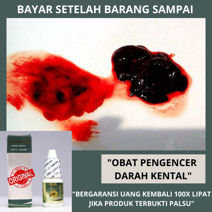 Obat Darah Kental Alami Obat Pengencer Darah Obat Darah Kental Obat Pembekuan Darah Obat 9828