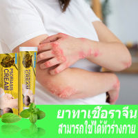 ยาแก้คันของจีน แก้คัน ยาทาคันเชื้อรา  จบทุกปัญหาเรื่องผิวหนังpsoriasis cream thailand  มีผลในการป้องกันการเจริญเติบโตของเชื้อรา  สารสกัดจากพืชใช้ได้ทั้งตัว  เหมาะสำหรับจ๊อคคัน สะเก็ดเงิน ทากากเกลื้อน ผื่นแพ้ผิวหนัง กลาก โรคผิวหนังคันครีมลดอาการคัน