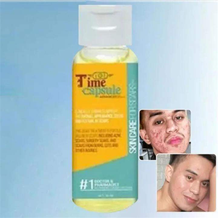 Authentic Time Capsule By.Dra. Vicky Belo, anti acne,for scars old scar