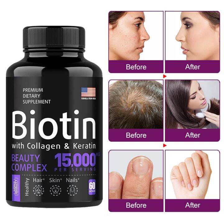 Biotin Capsules Collagen and Keratin Hair Growth Nails Skin Care Beauty ...