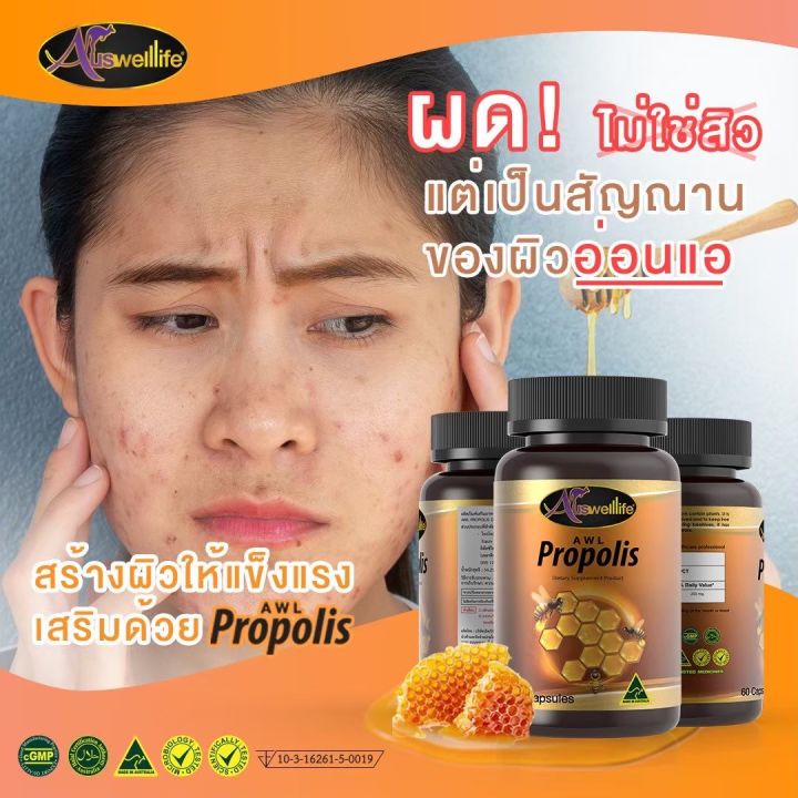 propolis-พรอพอลิส-1-000มก-สิวหายเร็ว-บำรุงผิวให้ห่างไกลสิว-บำรุงร่างกายลดอาการภูมิแพ้-ส่งฟรี