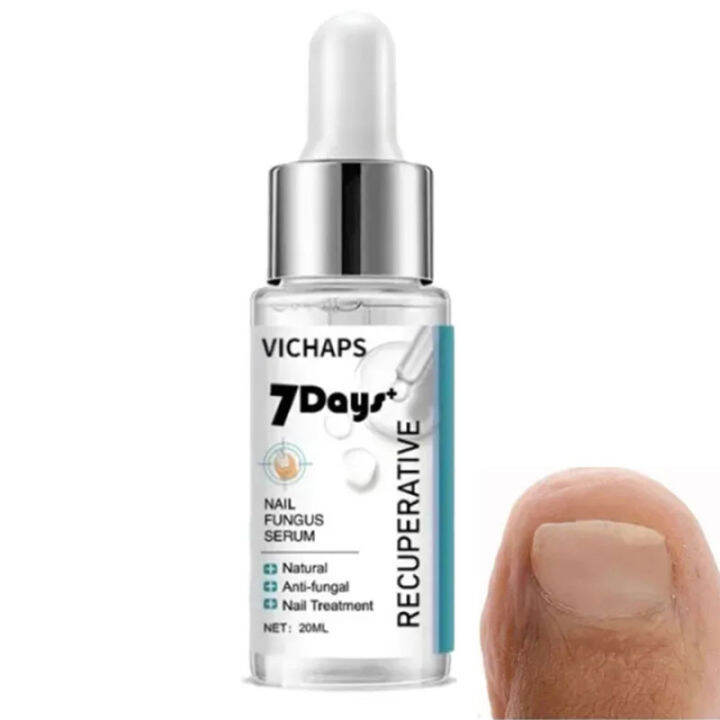 Cuticle Oil Nail Treatment Serum Anti Fungal Serum Nail Care Solution