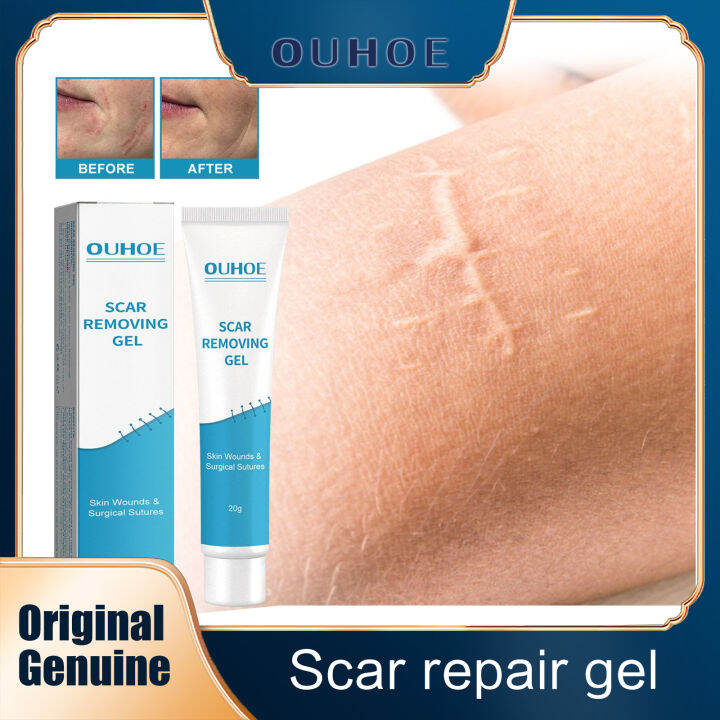 Ouhoe Scar Removing Gel Scars Removal Creams Stretch Marks Burn