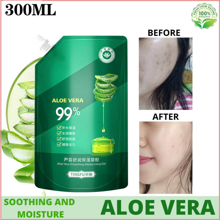 Authentic And Natural Korean Aloe Vera 99 Moisture And Soothing Gel 300ml Lazada Ph 5585