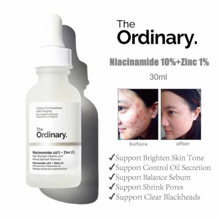 The ordinary flagship store The Ordinary Niacinamide zinc whitening 10% ...