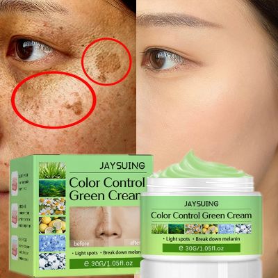 Whitening Freckles Cream Remove Melasma Dark Spot Lightening