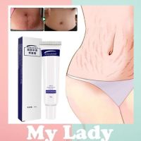 Mylady Aimabird Stretch Mark Repair Cream Aimabird ครีมบำรุงผิว สกินแคร์ ครีมท้องลาย ครีมทาผิวแตกกลาย  Aimabird Stretch Mark Repair Cream030