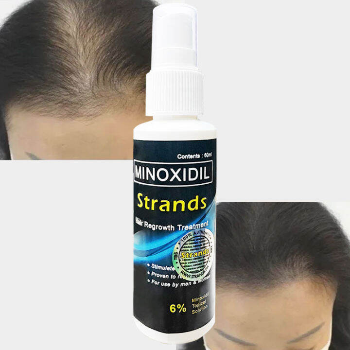 Minoxidil Stand 6% Hair Growth Essential Hair Loss Treatment Prevent ...