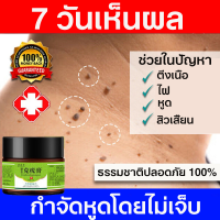 Corns warts removal ขี้แมลงวัน หูดตาปลาและติ่งเนื้อ ไฝ ครีมแต้มหูด ลอกหูดตาปลา ปลอดภัยไม่เจ็บ ไม่ทิ้งร่องรอยป