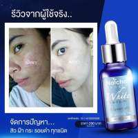 Natcha นัชชา เชรั่มณัชชา ขนาด30มล (4ขวด) ของแท้100% ส่งฟรี