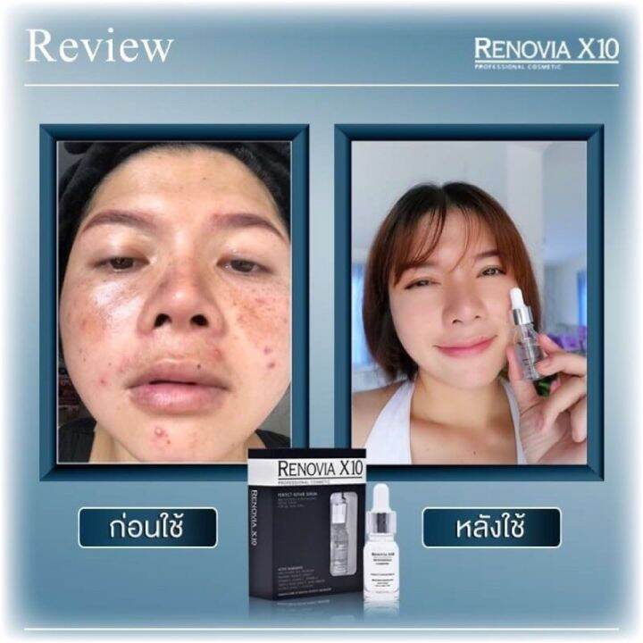 ตรงปก-จบปัญหาผิวหน้า-ของแท้-renovia-x10-professional-cosmetic-ฺั-by-18-อีกครั้ง