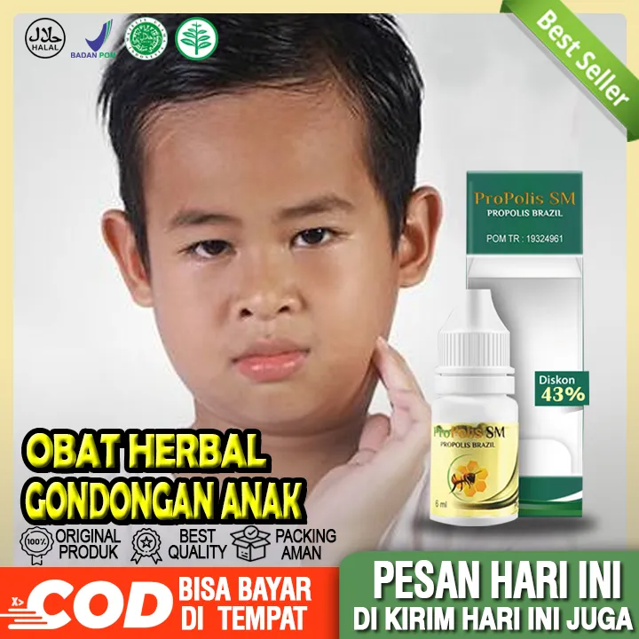 Obat Gondongan, Obat Oles Gondongan, Obat Gondongan Anak, Obat