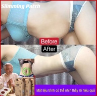 Hộp 10 Miếng Dán Rốn Tan Mỡ Trung Y Slimming Patch - Thảo Dược Nội địa Trung thumbnail