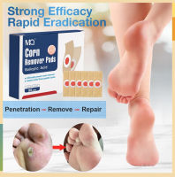 24Pcs Feet Corns/ Warts Removal Patch Pain Relief Remover Feet Callus Remove Soften Skin Cutin Sticker Medical Plaster Feet Care Tool Foot Patch warts removal patches feet corns warts removal patch