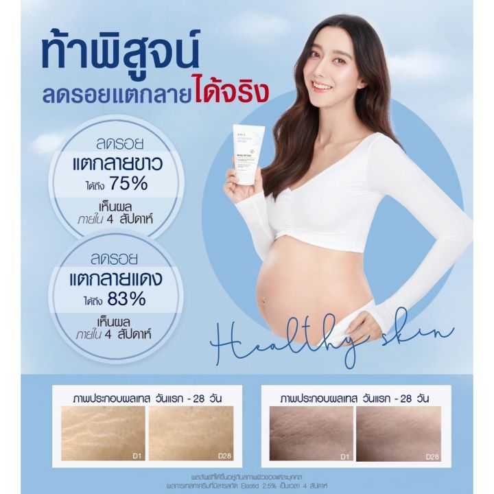 ส่งฟรี-ของแท้-ราคาโปร-แถมถุงผ้า-อีฟส์ออยล์-ออยล์เจล-ลดเลือนรอยแตกลาย-บำรุงผิวเนียนนุ่ม-คืนความชุ่มชื้นให้ผิว