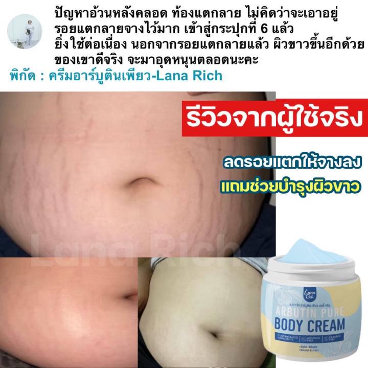 พร้อมส่งฟรี-ของแท้จากบริษัท-ครีมอาร์บูติน-สบู่อาร์บูติน-เพียว-ขาวไว-ป้องกันผิวแห้ง-ผิวแตกลาย-รอยแผลเป็น-น้ำเหลืองไม่ดี-เร่งขาว