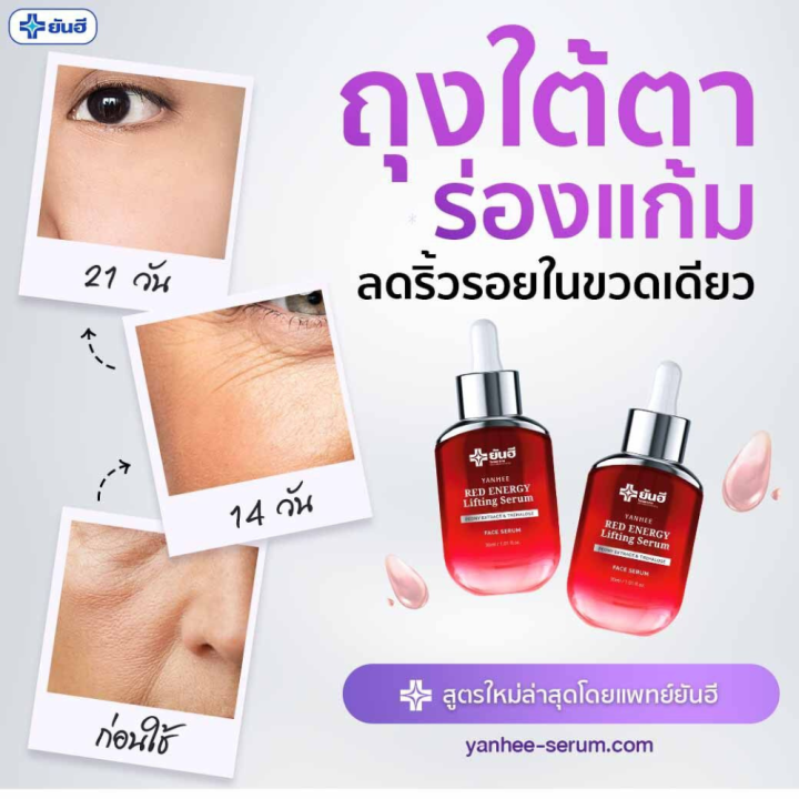 เซรั่มแดงยันฮี-เรดเอเนจี้-yanhee-red-energy-lifting-serum-2-ขวด-ลดเลือนริ้วรอย-รอยแดง-รอยดำ-ร่องลึก-ถุงใต้ตา-ของแท้100-ขนาด-30ml-พร้อมส่ง-ส่งฟรีส่งด่วน