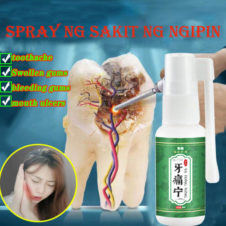 Toothache Relieving Spray Herbal Medicine Cavities Antibacterial Herbal